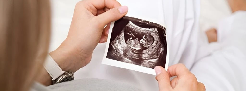 متابعة-الحمل